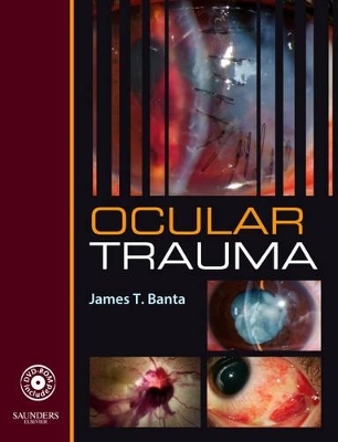 Ocular Trauma - James T. Banta