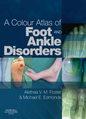 A Colour Atlas of Foot and Ankle Disorders - Alethea VM Foster, Michael E. Edmonds