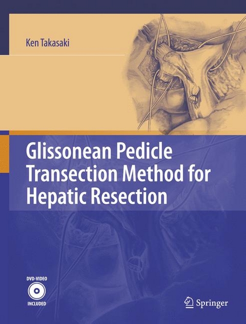 Glissonean Pedicle Transection Method for Hepatic Resection - Ken Takasaki