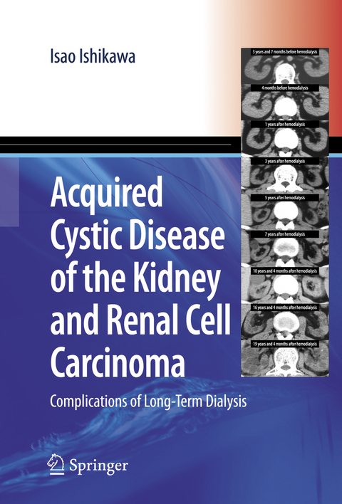 Acquired Cystic Disease of the Kidney and Renal Cell Carcinoma - Isao Ishikawa
