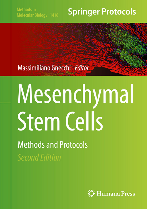 Mesenchymal Stem Cells - 