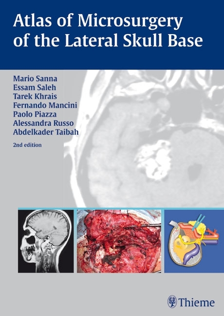 Atlas of Microsurgery of the Lateral Skull Base - Mario Sanna, Tarek Khrais, Fernando Mancini, Essam A. Saleh, Paolo Piazza, Alessandra Russo, Abdelkader Taibah