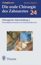 Wurzelspitzenresektion im Seitenzahnbereich - Johannes K. Bartsch