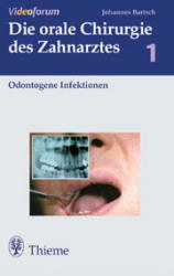 Odontogene Infektionen - Johannes K. Bartsch