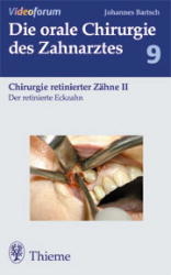 Der retinierte Eckzahn - Johannes K. Bartsch