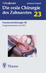 Gingivaextension mit FST - Johannes K. Bartsch