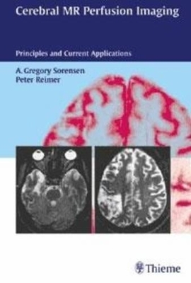 Cerebral MR Perfusion Imaging - Gregory Sorensen, Peter Reimer