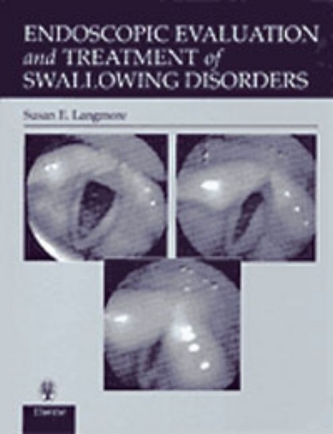 Endoscopic Evaluation and Treatment of Swallowing Disorders -  Susan E. Langmore