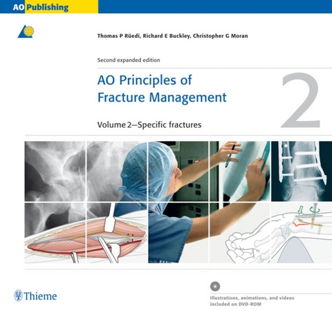 AO Principles of Fracture Management - Thomas Rüedi
