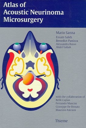 Atlas of Acoustic Neurinoma Microsurgery - Mario Sanna