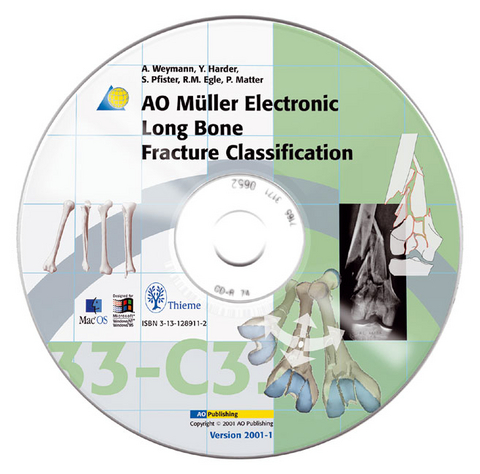 AO Müller Electronic Long Bone Fracture Classification, CD-ROM