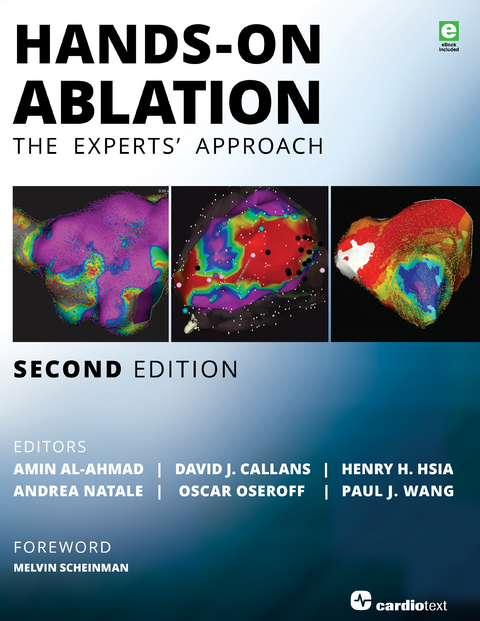 Hands-On Ablation - 