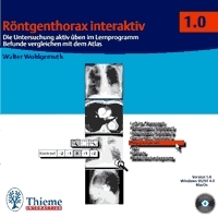 Röntgenthorax interaktiv (CD-ROM) - Walther A Wohlgemuth