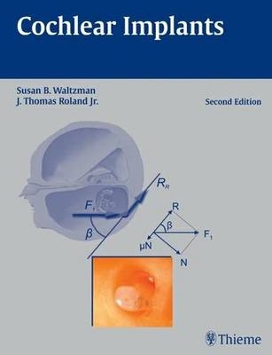 Cochlear Implants - Susan B. Waltzman, J. Thomas Roland Jr.