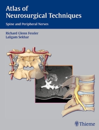 Atlas of Neurosurgical Techniques - Richard G. Fessler, Laligam N. Sekhar