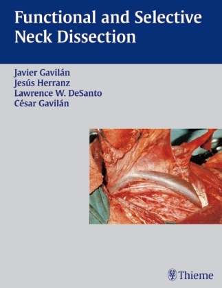 Functional and Selective Neck Dissection - Jesus Herranz Javier Gavilan