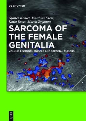 Sarcoma of the Female Genitalia / Smooth muscle and stromal tumors and prevention of inadequate surgery - Günter Köhler, Matthias Evert, Katja Evert, Marek Zygmunt