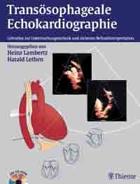 Transösophageale Echokardiographie - 
