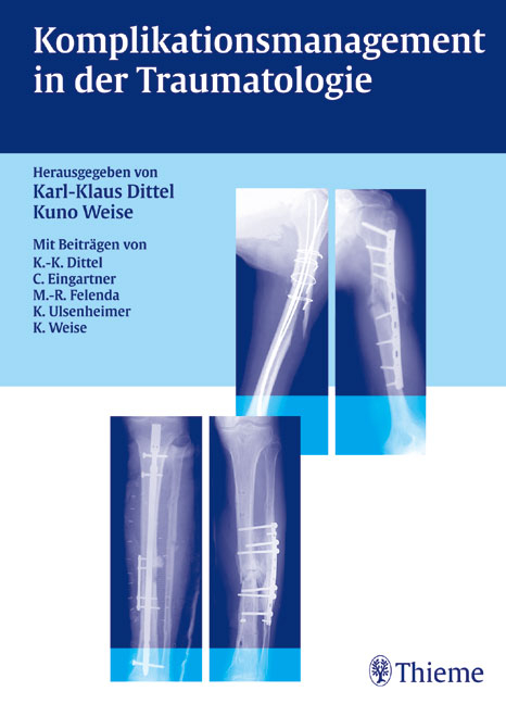 Komplikationsmanagement in der Traumatologie - Karl K Dittel, Kuno Weise