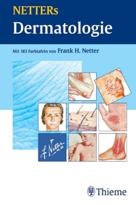 NETTERs Dermatologie - Frank H Netter