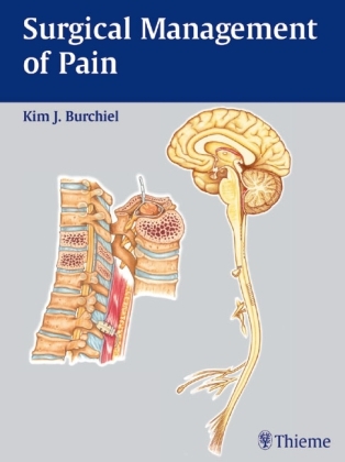 Surgical Management of Pain - Kim Kim J. Burchiel