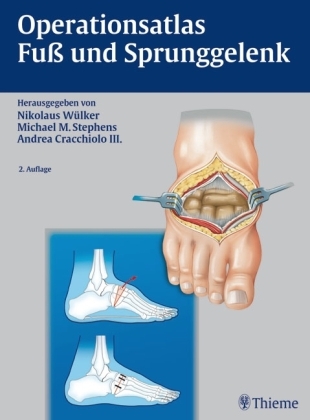 Operationsatlas Fuß und Sprunggelenk - Nikolaus Wülker