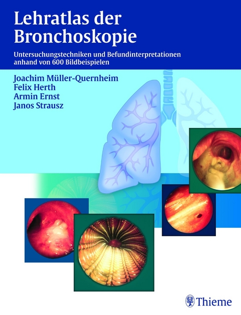 Lehratlas der Bronchoskopie - Joachim Müller-Quernheim, Felix Herth, Janos Strausz