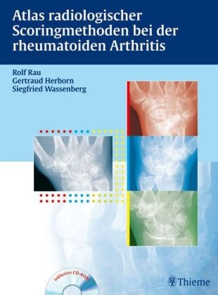 Atlas der Scoringmethoden bei der rheumatoiden Arthritis - Rolf Rau, Gertraud Herborn, Siegfried Wassenberg