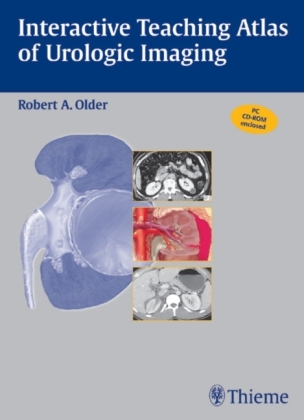 Interactive Teaching Atlas of Urologic Imaging - Robert Older