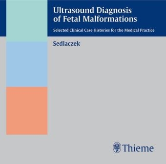 Ultrasound Diagnosis of Fetal Malformations (CD-ROM) - Helmut Sedlaczek