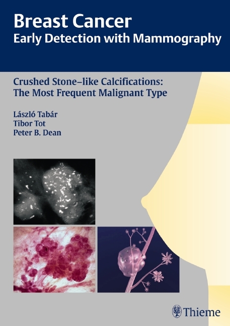 Breast Cancer: Early Detection with Mammography - Laszlo Tabar, Tibor Tot, Peter B. Dean