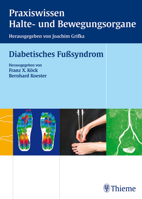 Diabetisches Fußsyndrom - 
