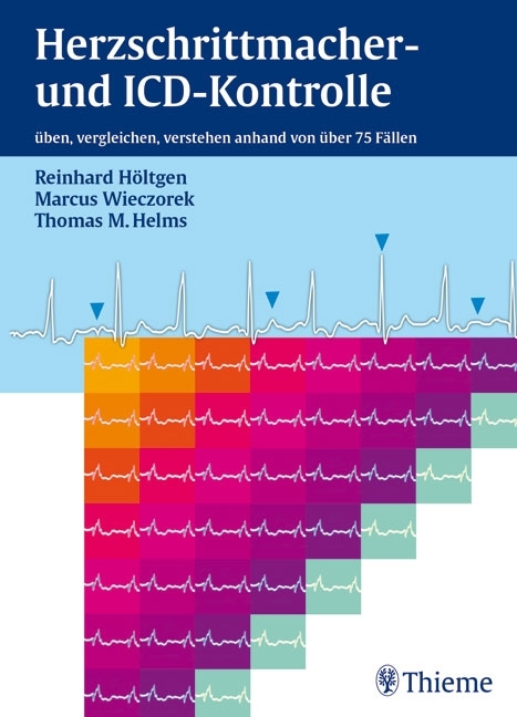 Herzschrittmacher- und ICD-Kontrolle - Reinhard Höltgen, Marcus Wieczorek, Thomas M. Helms