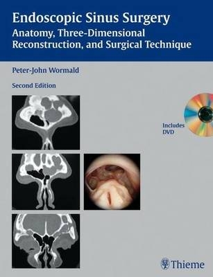 Endoscopic Sinus Surgery - Peter-John Peter-John Wormald