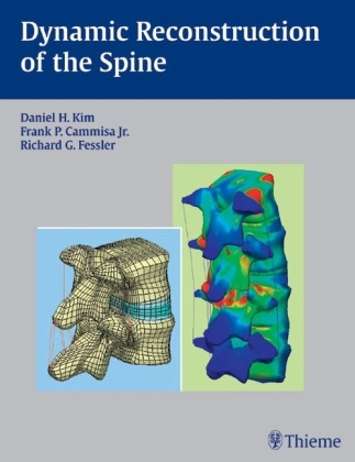 Dynamic Reconstruction of the Spine - Daniel H. Kim, Frank P. Cammisa Jr., Richard G. Fessler