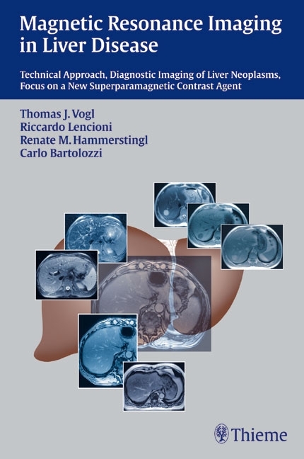 Magnetic Resonance Imaging in Liver Disease - Thomas Vogl, Riccardo Lencioni, Renate Hammerstingl