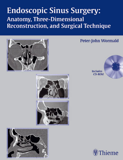 Endoscopic Sinus Surgery (incl. CD-ROM) - Peter J Wormald