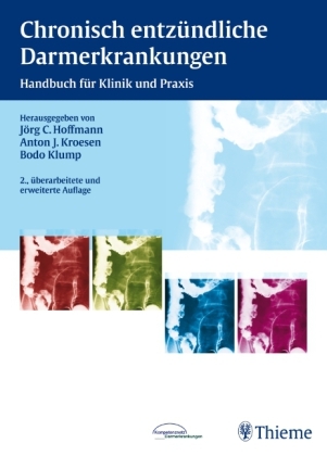 Chronisch entzündliche Darmerkrankungen - Jörg C. Hoffmann, Anton J. Kroesen, Bodo Klump