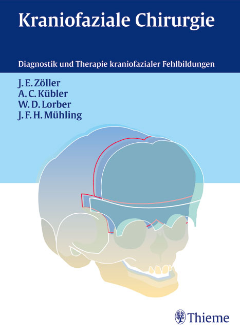 Kraniofaziale Chirurgie - Joachim E Zöller, Alexander C Kübler, Wilma D Lorbeer, Joachim F H Mühling
