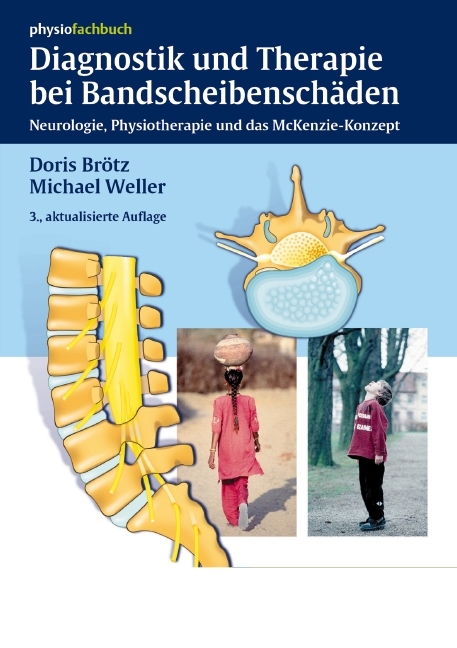 Diagnostik und Therapie bei Bandscheibenschäden - Doris Brötz, Michael Weller