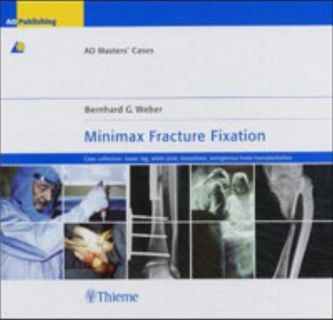 Minimax Fracture Fixation - Bernhard G. Weber