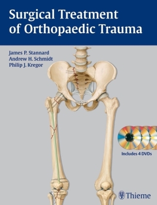 Surgical Treatment of Orthopaedic Trauma - Andrew H. Schmidt James Patrick Stannard