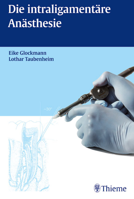 Die intraligamentäre Anästhesie (in der Zahnheilkunde) - Eike Glockmann, Lothar Taubenheim