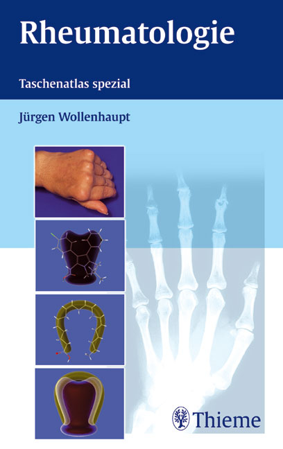 Rheumatologie - Jürgen Wollenhaupt