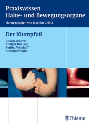 Der Klumpfuß - 