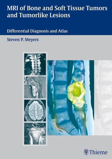 MRI of Bone and Soft Tissue Tumors and Tumorlike Lesions - Steven Meyers