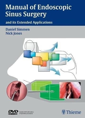 Manual of Endoscopic Sinus Surgery - Daniel Simmen, Nick Jones, Klinik Hirslanden ORL-Zentrum