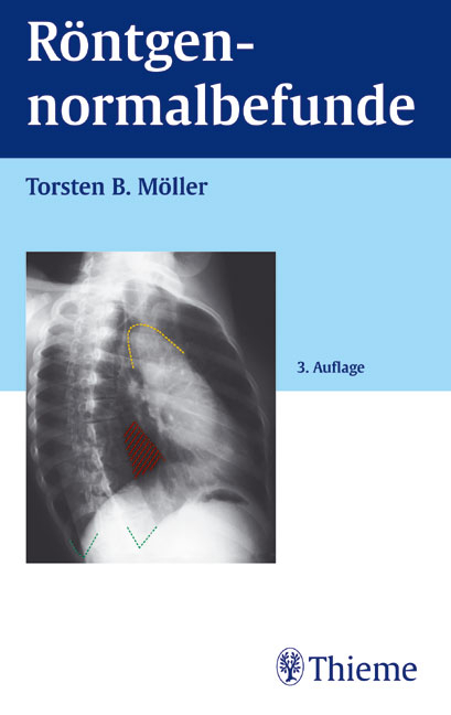 Röntgennormalbefunde - Torsten B Möller