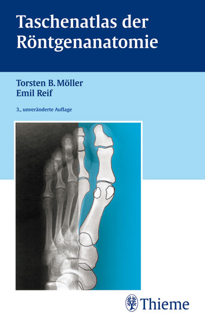 Taschenatlas der Röntgenanatomie - Torsten B Möller, Emil Reif