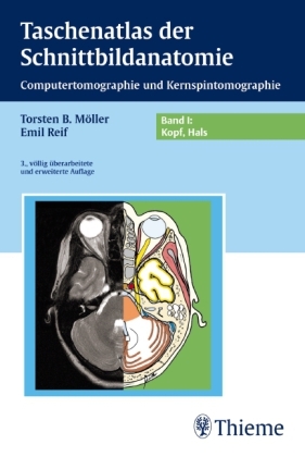 Taschenatlas der Schnittbildanatomie. Computertomographie und Kernspintomographie / Band I: Kopf, Hals - Torsten Bert Möller, Emil Reif